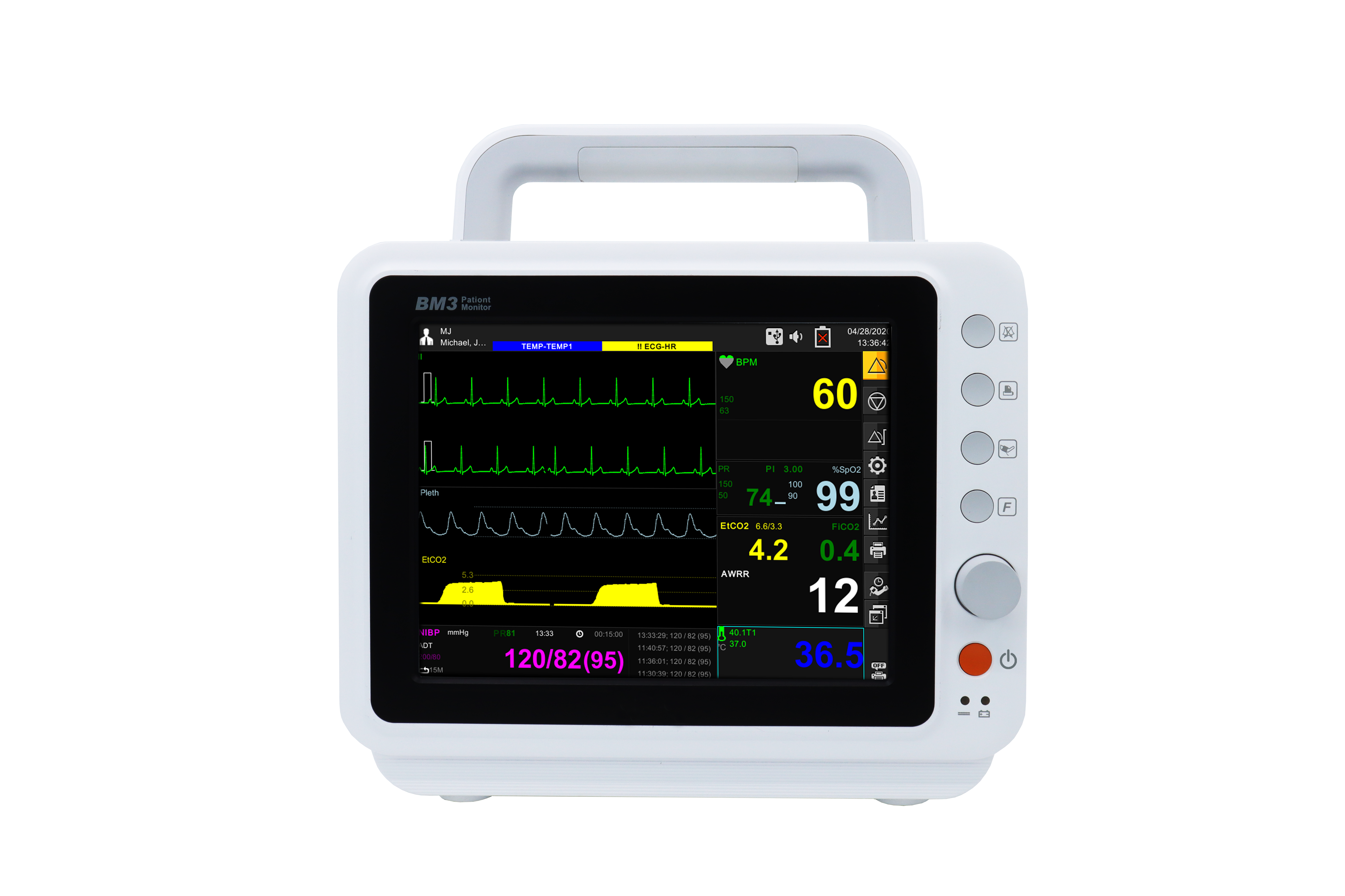 Монитор пациента вм1. Прикроватный монитор пациента. Монитор пациента bionet bm 1. Монитор пациента вм3 bionet корея. Bionet bm7 pro.